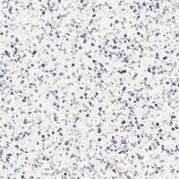 MN1L Керамогранит Frammento Macro Azzurro R10 RT 60x60